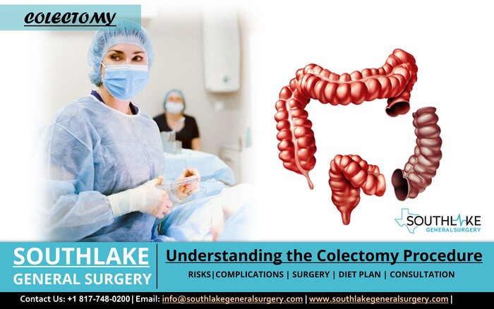 Understanding the Colectomy Procedure