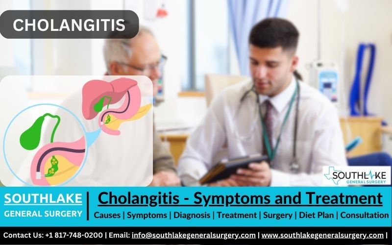 Cholangitis - Symptoms and Treatments