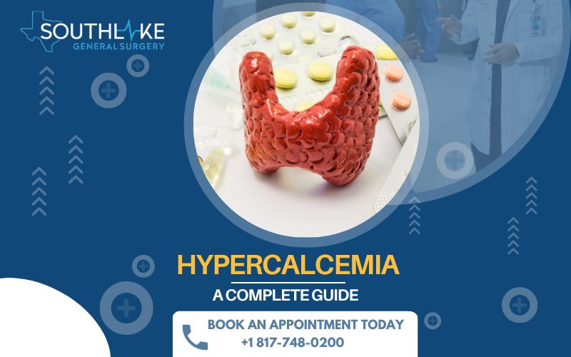 Hypercalcemia: A Complete Guide