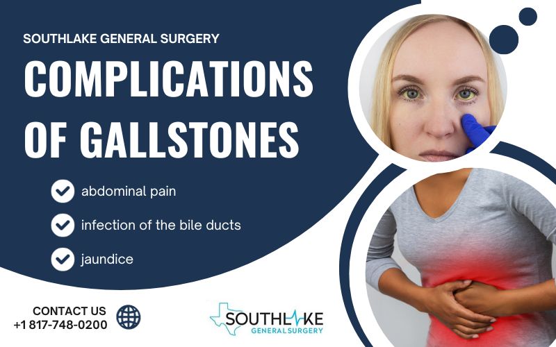 A person suffering from complications of gallstones.