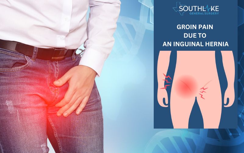 Understanding Groin Pain: Causes, Relief, and When to Worry