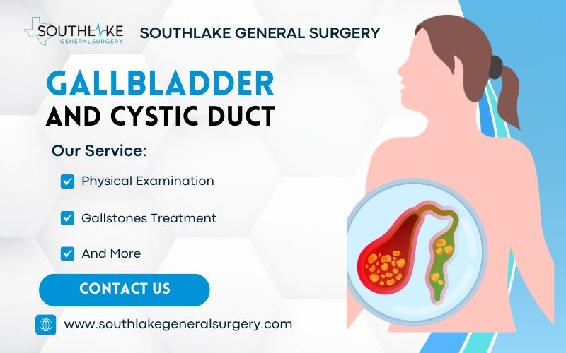A diagram of the gallbladder and cystic duct