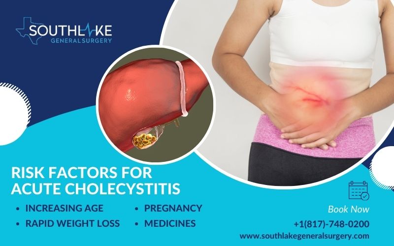 A diagram of the gallbladder and bile ducts, showing the risk factors for acute cholecystitis.