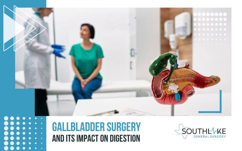 Illustration depicting gallbladder surgery and its impact on digestion.