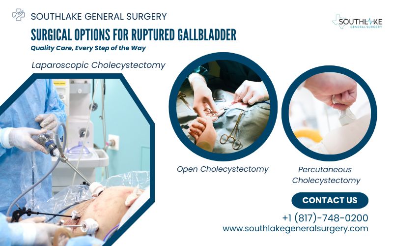 Comparison of surgical options for ruptured gallbladder: laparoscopic cholecystectomy, open cholecystectomy, and percutaneous cholecystostomy.