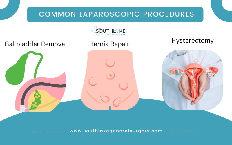 Common Laparoscopic Procedures: Icons depicting gallbladder removal, appendectomy, hernia repair, and hysterectomy.