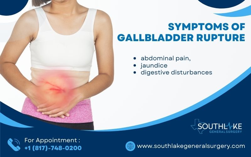 Illustration of symptoms of gallbladder rupture, including abdominal pain, jaundice, and digestive disturbances.