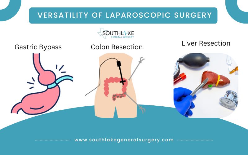 Versatility of Laparoscopic Surgery: Images illustrating various procedures, including gastric bypass, colon resection, and liver resection.