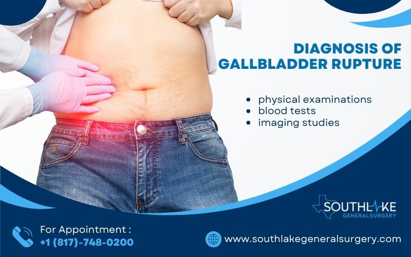 Medical professionals conducting tests for gallbladder rupture diagnosis: physical exam, blood tests, and imaging studies.