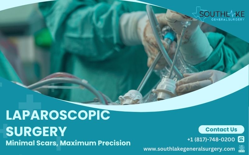 Laparoscopic Surgery: Minimal Scars, Maximum Precision