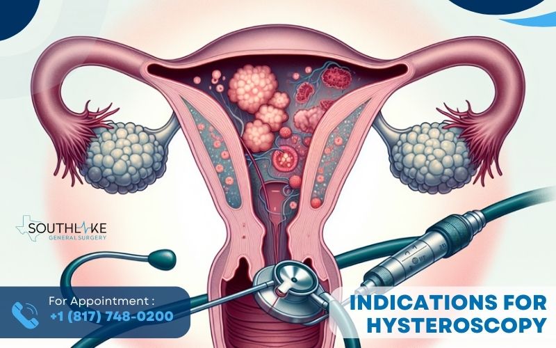 Illustration of uterine conditions such as polyps and fibroids.