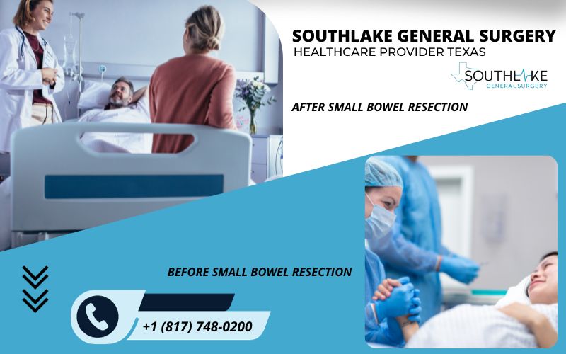 Image showing preoperative and postoperative stages of small bowel resection recovery: monitored recovery area, pain management, wound care, and follow-up appointments.