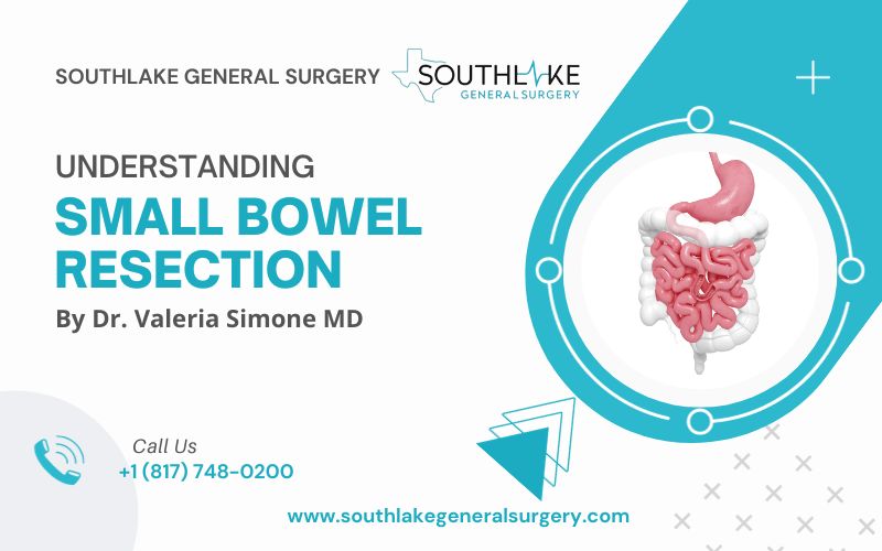 Understanding Small Bowel Resection