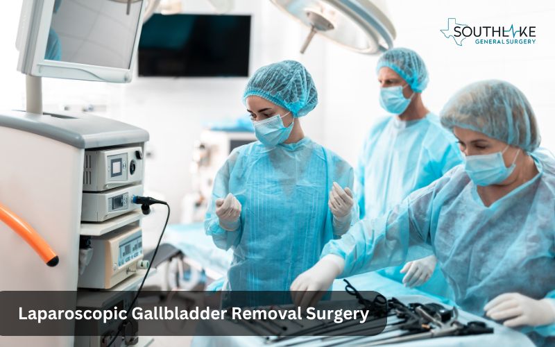 An image of doctors preparing for Laparoscopic gallbladder surgery.