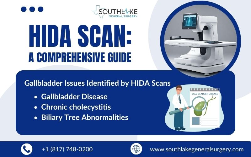 HIDA Scan A Comprehensive Guide