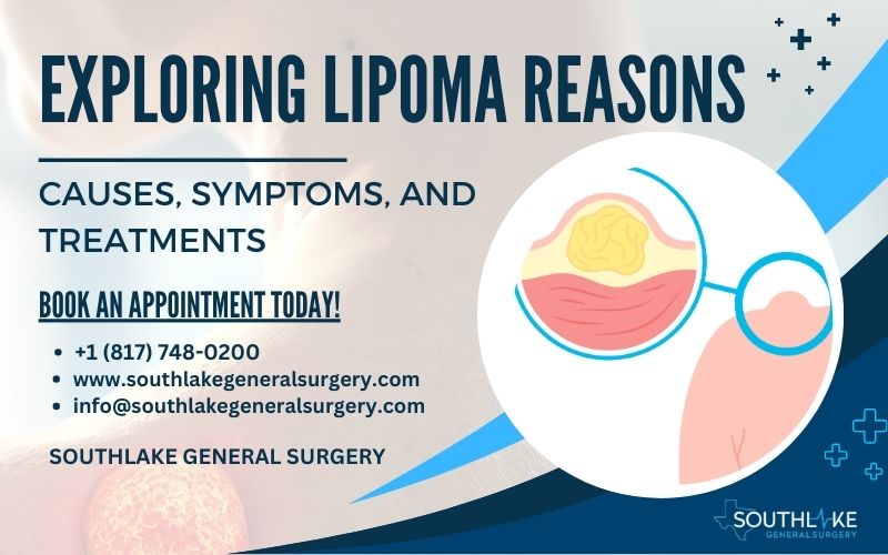 Exploring Lipoma Reasons - Causes, Symptoms, and Treatments