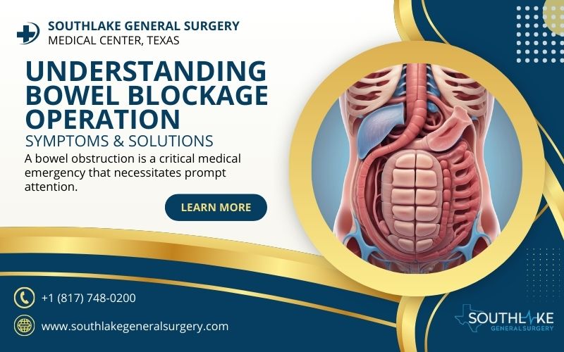Understanding Bowel Blockage Operation - Symptoms & Solutions