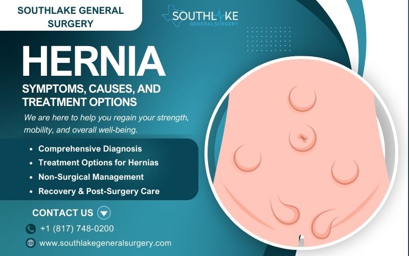 Illustration of a hernia showing tissue pushing through a weak spot in the abdominal wall."