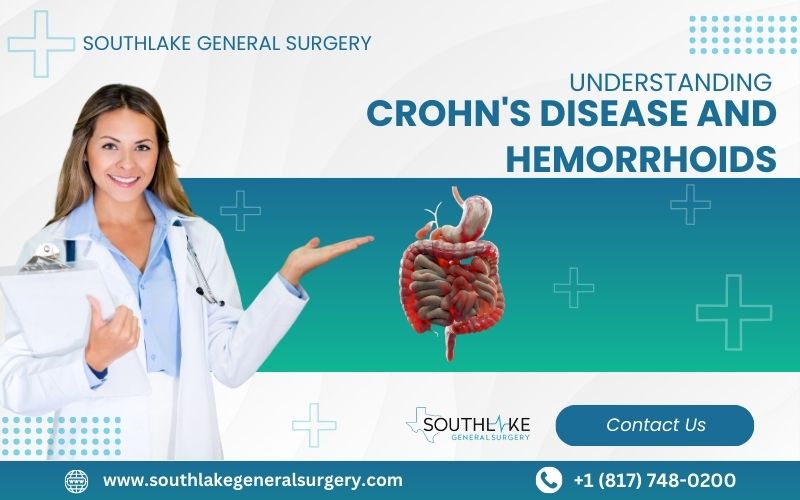 Diagram showing the gastrointestinal tract with areas affected by Crohn's disease and hemorrhoids highlighted.