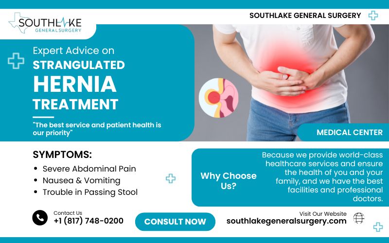Expert Advice on Strangulated Hernia Treatment