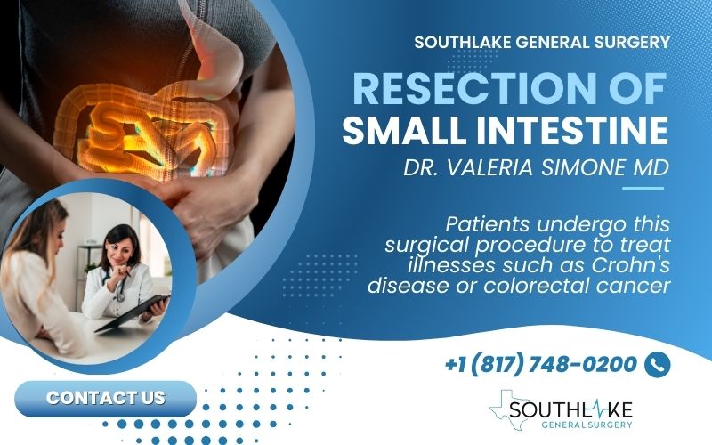 Resection of Small Intestine Navigating Risks & Benefits