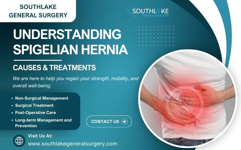 Understanding Spigelian Hernia Causes & Treatments