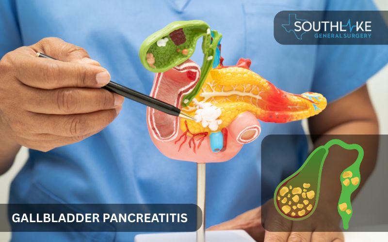 Infographic showing gallstone obstruction in the pancreatic duct and buildup of digestive enzymes.