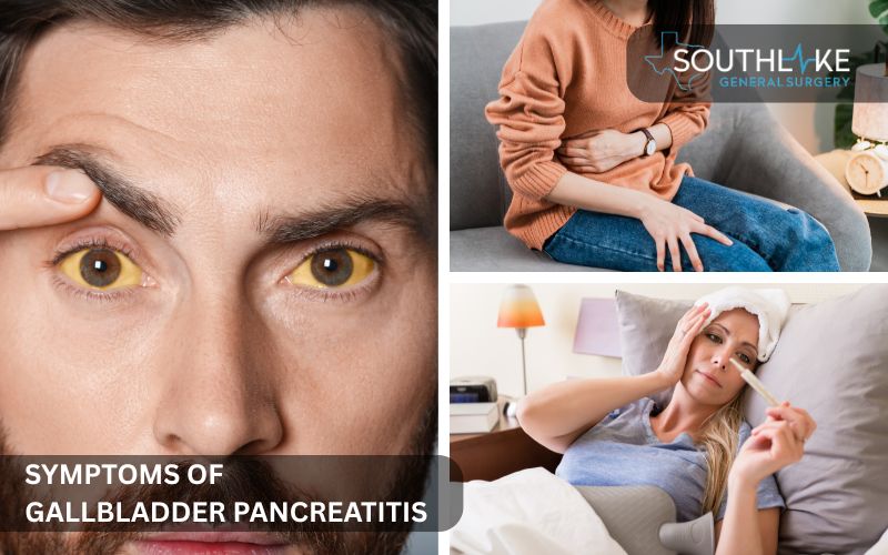 Diagram showing common symptoms of gallbladder pancreatitis including abdominal pain, jaundice, and vomiting.
