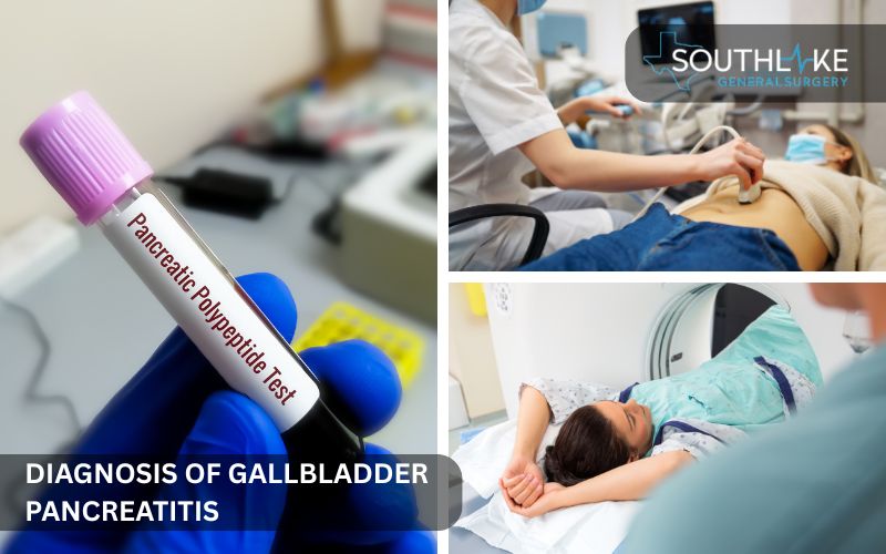 Medical tools used for diagnosing gallbladder pancreatitis such as ultrasound, CT scan, and blood tests.