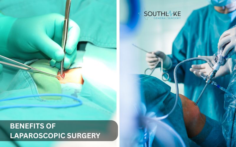 Comparison between traditional open hernia surgery and minimally invasive laparoscopic repair with smaller incisions and faster recovery.