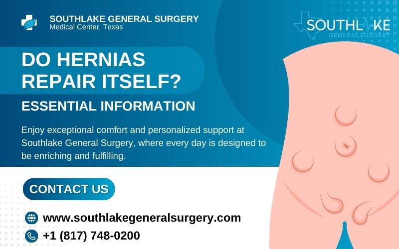 Medical illustration showing different types of hernias—inguinal, femoral, umbilical, and incisional—highlighting affected areas in the abdomen.