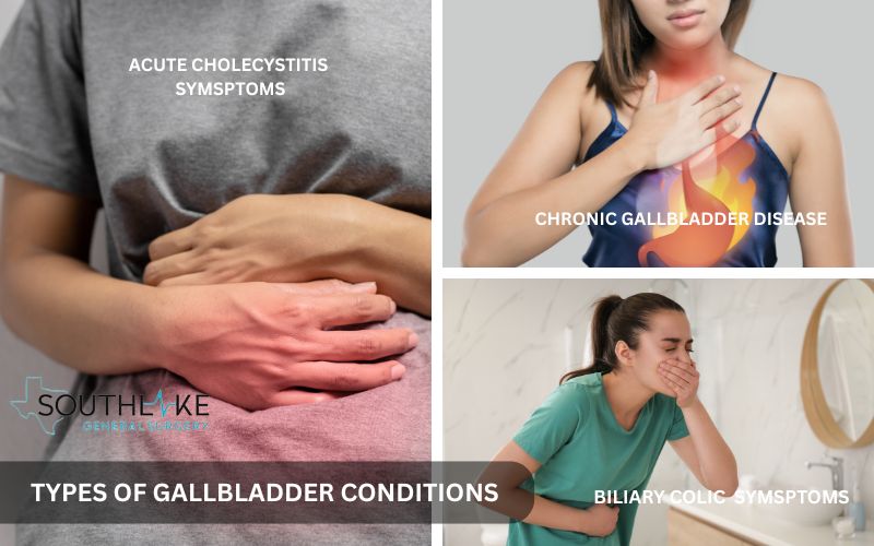 Infographic highlighting symptoms and severity of acute cholecystitis, chronic gallbladder disease, and biliary colic.