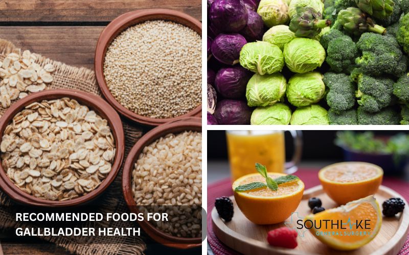 A colorful assortment of high-fiber fruits, vegetables, and whole grains recommended for a healthy gallbladder diet.