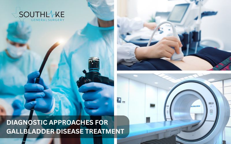 Diagnostic tools used in gallbladder disease—ultrasound, HIDA scan, and endoscopic ultrasound.