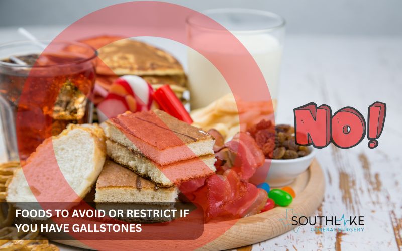 Image depicting high-fat, fried, and sugary processed foods that should be limited or avoided for gallbladder health.