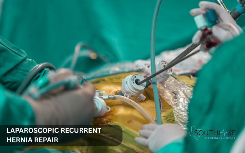 Image of Laparoscopic recurrent hernia repair at Southlake General Surgery, Texas, USA.