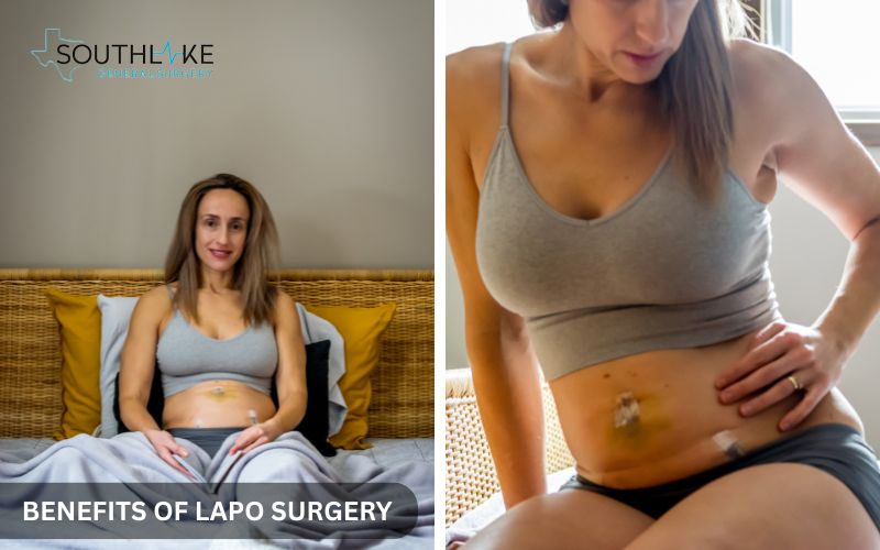 Happy patient recovering quickly at home after minimally invasive lapo surgery.